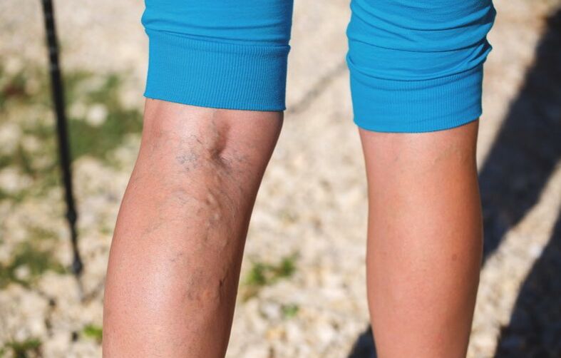 Damáiste do na foircinn íochtaracha