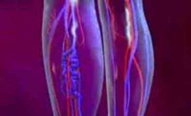 Cúiseanna agus cóireáil féitheacha borrtha